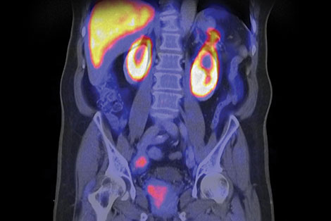 UF Abdominal and General Body Imaging
