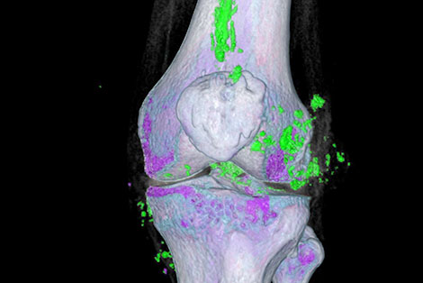 UF musculoskeletal radiology imaging